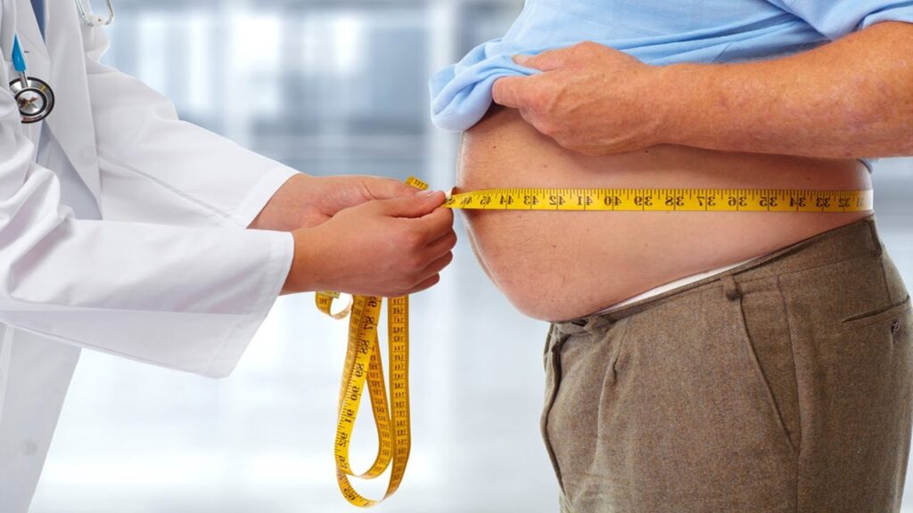 Что такое хирургия ожирения?