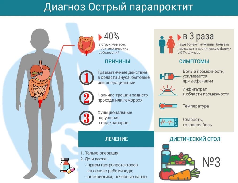 Острый парапроктит: Лечение в Ташкенте | Причины, Симптомы