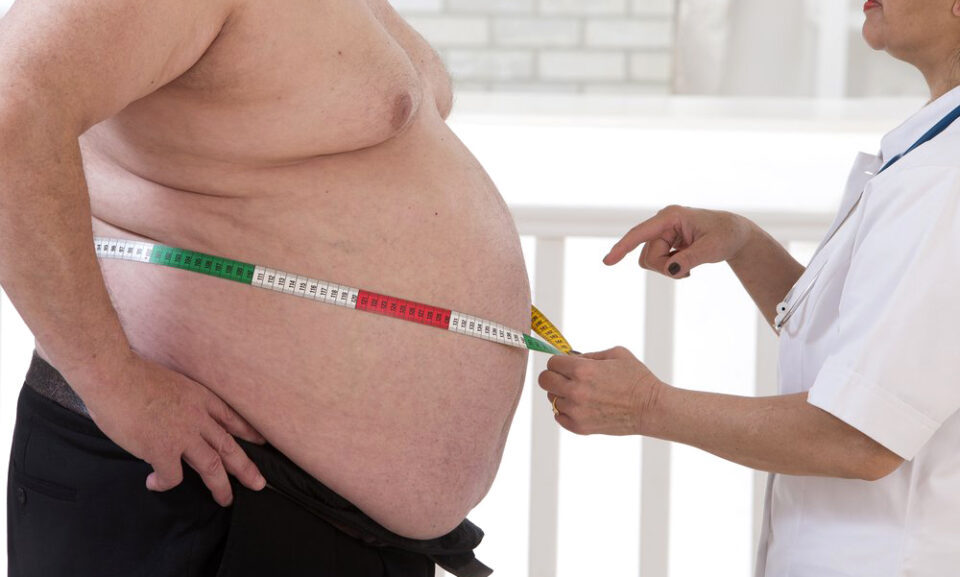 Хирургия ожирения: Как избавиться от лишнего веса?